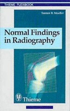 Normal Findings in Radiography by Torsten B. Moller