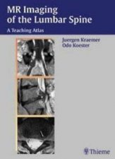 MRI of the Lumbar Spine