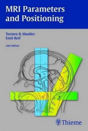 MRI Parameters and Positioning by Torsten Moeller