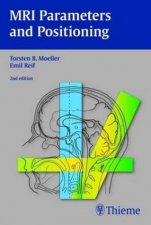 MRI Parameters and Positioning