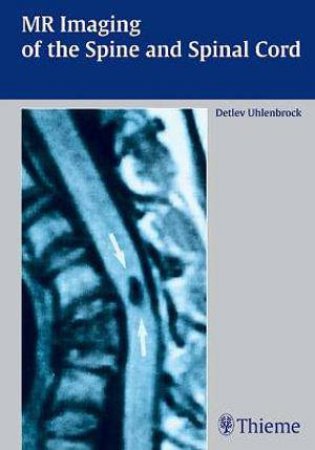 MR Imaging of the Spine and Spinal Cord by Detlev Uhlenbrock