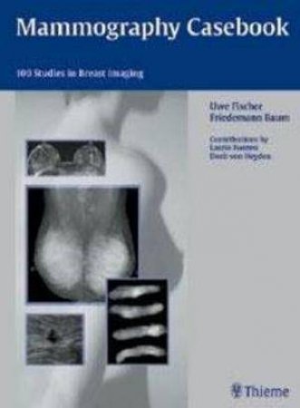 Mammography Casebook by Uwe Fischer