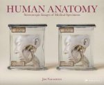 Human Anatomy Stereoscopic Images Of Medical Specimens